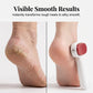 🦶 Double-Sided Foot Scraper for Callus Removal